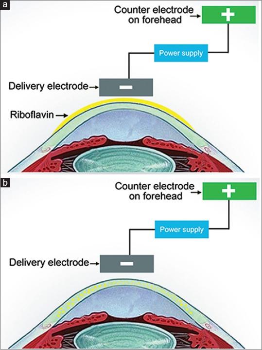 https://cdn.ncbi.nlm.nih.gov/pmc/blobs/b3fd/6324097/504f92e13bd1/IJO-67-8-g005.jpg