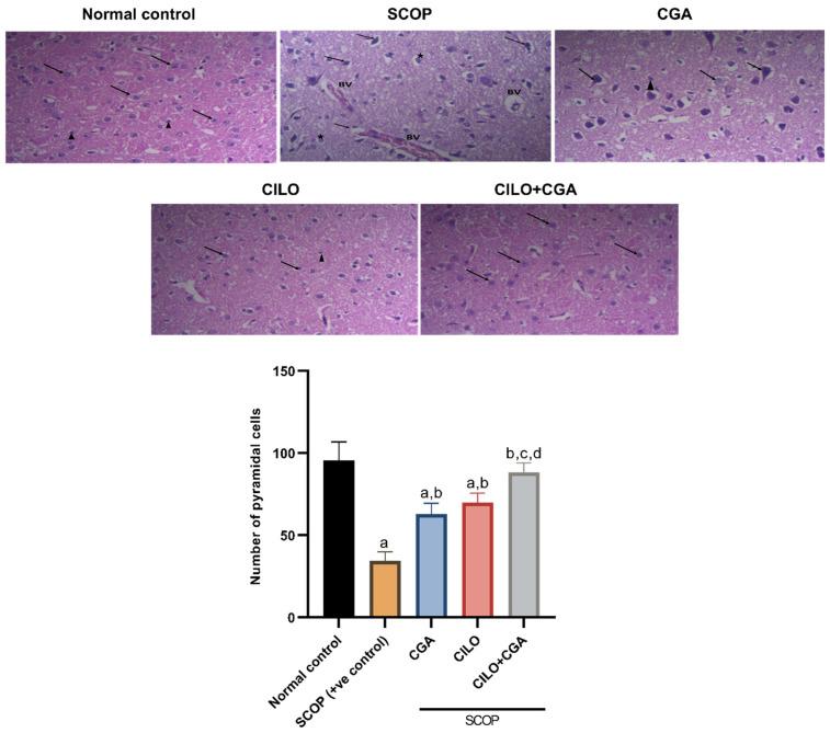 https://cdn.ncbi.nlm.nih.gov/pmc/blobs/b3ff/11988773/77c6b5ff73a1/ijms-26-03108-g002.jpg