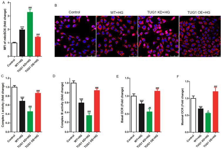 https://cdn.ncbi.nlm.nih.gov/pmc/blobs/b407/8815052/133160a4e7d1/etm-23-03-11161-g02.jpg