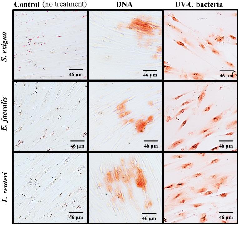 https://cdn.ncbi.nlm.nih.gov/pmc/blobs/b409/10711090/5d57d72800fd/fcimb-13-1257433-g004.jpg