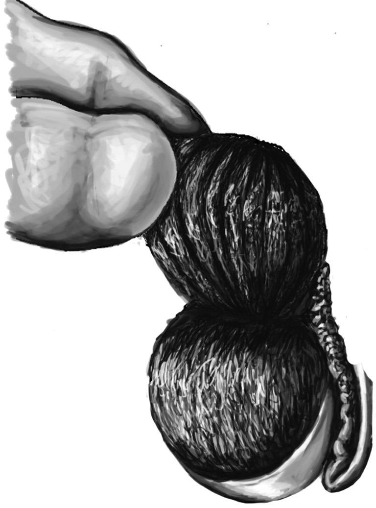 https://cdn.ncbi.nlm.nih.gov/pmc/blobs/b409/4708305/e0a93cdd4c54/tau-03-01-094-f1.jpg