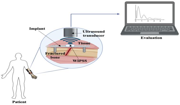 https://cdn.ncbi.nlm.nih.gov/pmc/blobs/b40f/11478373/d33d1241e1ca/sensors-24-06172-g003.jpg