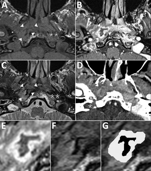 https://cdn.ncbi.nlm.nih.gov/pmc/blobs/b40f/6433013/1e6949d31661/18-0710-F.jpg