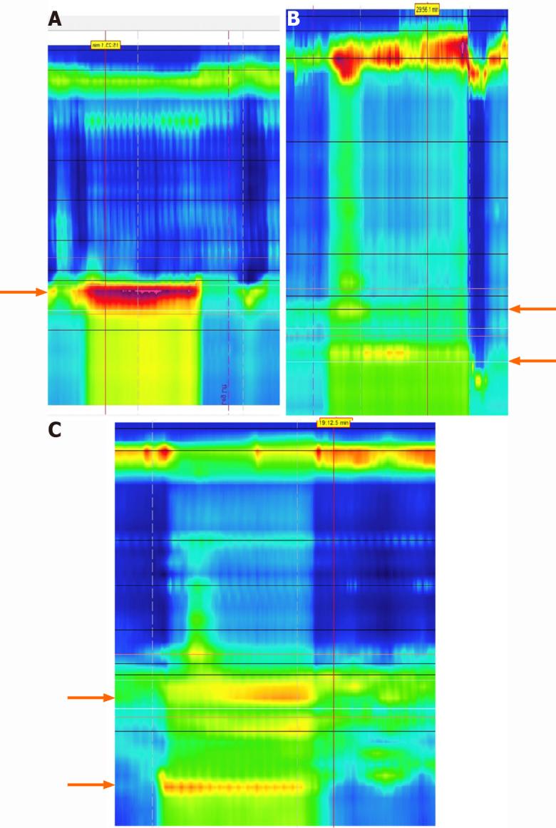 https://cdn.ncbi.nlm.nih.gov/pmc/blobs/b410/8072189/d1329a3ecba5/WJG-27-1751-g012.jpg