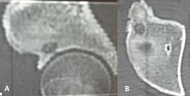 https://cdn.ncbi.nlm.nih.gov/pmc/blobs/b411/4546794/edc264c2755e/PAMJ-21-134-g001.jpg