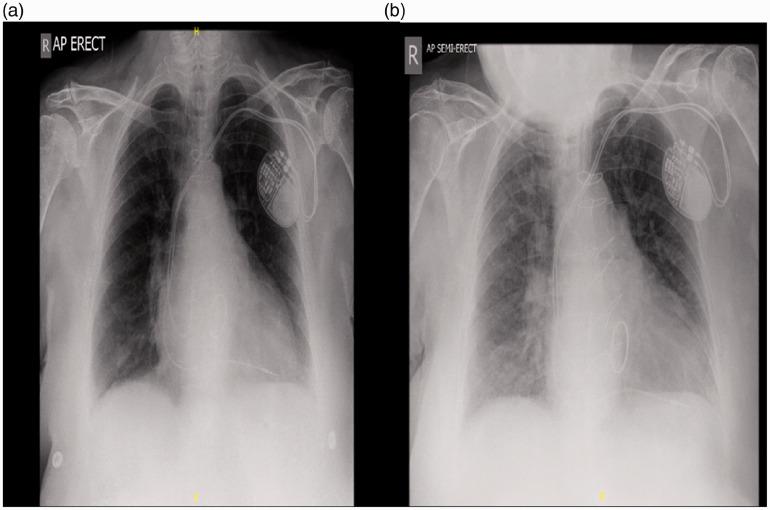 https://cdn.ncbi.nlm.nih.gov/pmc/blobs/b412/7457007/cc7c47236e28/10.1177_1460408620951352-fig2.jpg
