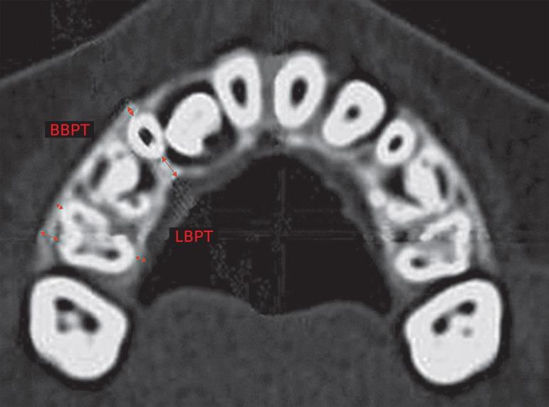 https://cdn.ncbi.nlm.nih.gov/pmc/blobs/b41c/4296626/cb26fdf3d6a9/dpjo-19-03-0036-g03.jpg
