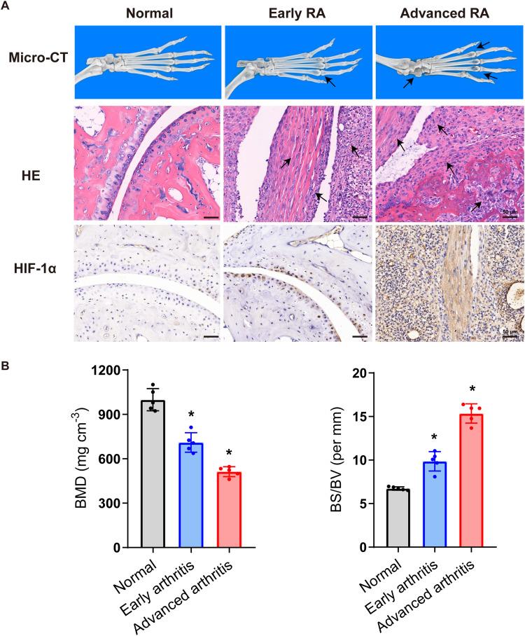 https://cdn.ncbi.nlm.nih.gov/pmc/blobs/b41e/12039933/9b352a3a63ae/IJN-20-5353-g0004.jpg