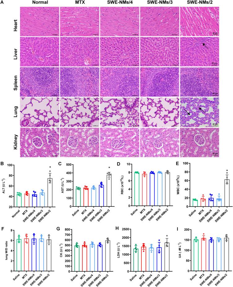 https://cdn.ncbi.nlm.nih.gov/pmc/blobs/b41e/12039933/b06638965e32/IJN-20-5353-g0007.jpg