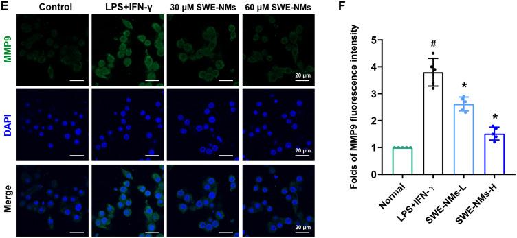 https://cdn.ncbi.nlm.nih.gov/pmc/blobs/b41e/12039933/d1e5beb7bd97/IJN-20-5353-g0011.jpg