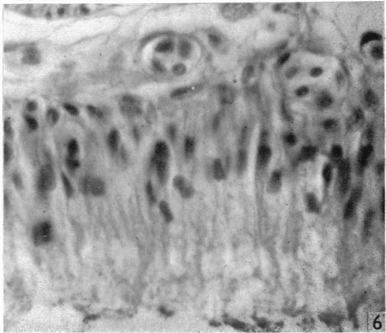 https://cdn.ncbi.nlm.nih.gov/pmc/blobs/b41e/1244603/65448718b56c/janat00469-0105-f.jpg