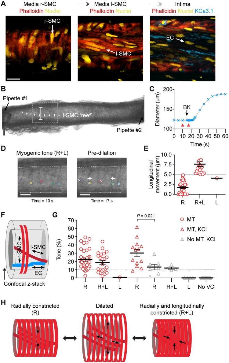 https://cdn.ncbi.nlm.nih.gov/pmc/blobs/b41f/9239576/2b9b1b953ddd/cvab218f3.jpg