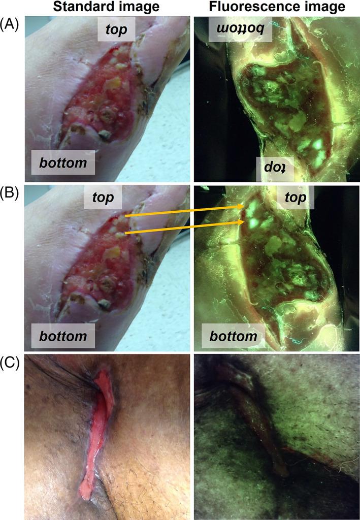https://cdn.ncbi.nlm.nih.gov/pmc/blobs/b422/9493216/bd016728ba63/IWJ-19-1438-g001.jpg
