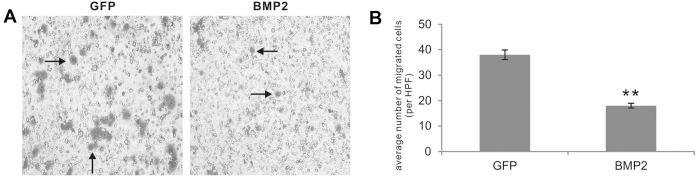 https://cdn.ncbi.nlm.nih.gov/pmc/blobs/b423/4121423/5abd9e6561e3/OR-32-03-1013-g02.jpg