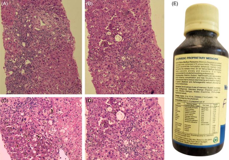 https://cdn.ncbi.nlm.nih.gov/pmc/blobs/b42c/10990366/a3b66fbd3bc8/hc9-8-e0417-g002.jpg