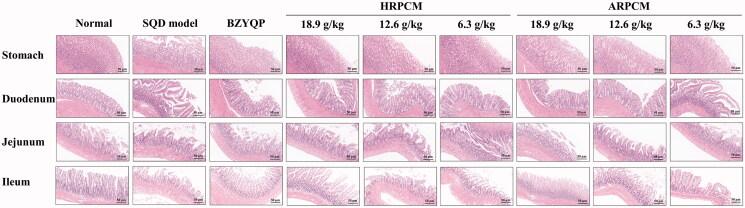 https://cdn.ncbi.nlm.nih.gov/pmc/blobs/b42e/9246251/328eba3ce756/IPHB_A_2086990_F0010_C.jpg