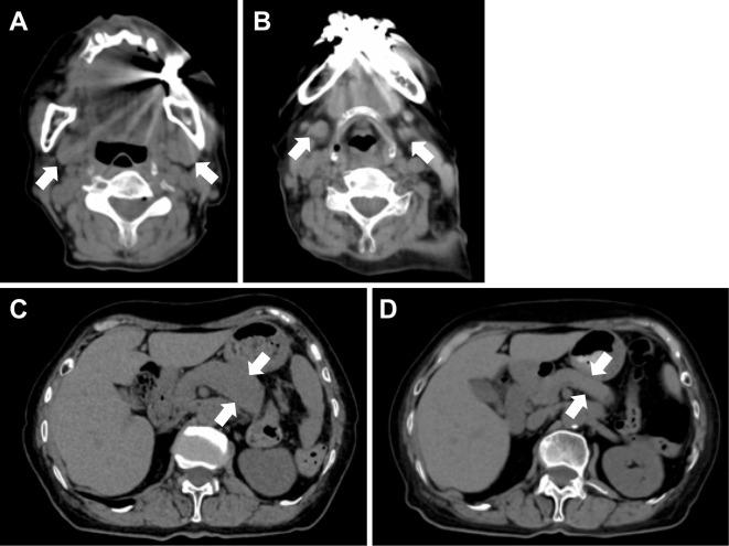 https://cdn.ncbi.nlm.nih.gov/pmc/blobs/b432/10258086/acb581ea5334/1349-7235-62-1547-g002.jpg