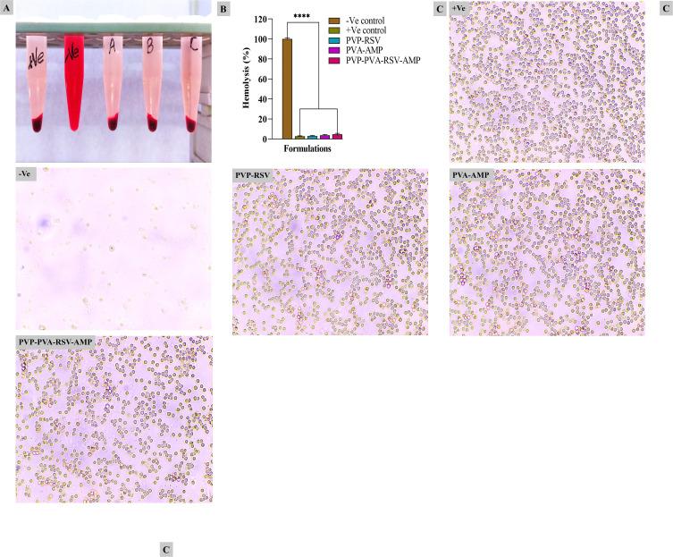 https://cdn.ncbi.nlm.nih.gov/pmc/blobs/b432/11164821/a2e22c252409/IJN-19-5397-g0009.jpg
