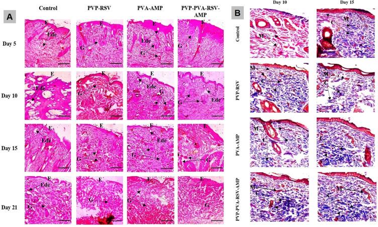 https://cdn.ncbi.nlm.nih.gov/pmc/blobs/b432/11164821/d76c8892aa27/IJN-19-5397-g0013.jpg