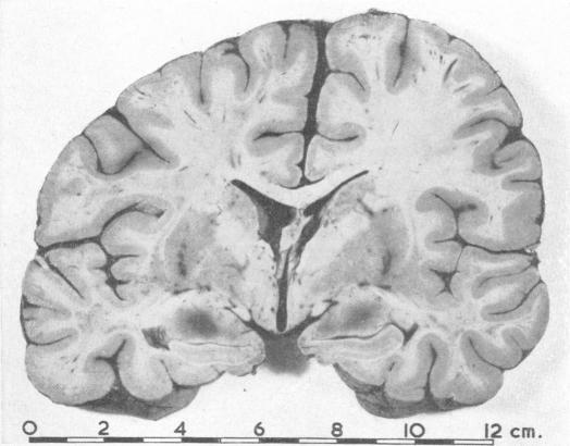 https://cdn.ncbi.nlm.nih.gov/pmc/blobs/b432/1844440/425acb045802/brmedj02547-0036-d.jpg