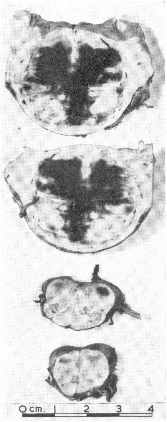 https://cdn.ncbi.nlm.nih.gov/pmc/blobs/b432/1844440/7039ac72f6c0/brmedj02547-0035-b.jpg