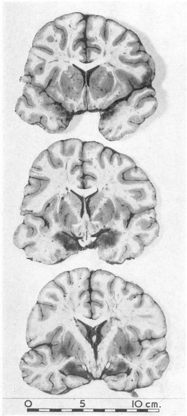 https://cdn.ncbi.nlm.nih.gov/pmc/blobs/b432/1844440/8580b034db02/brmedj02547-0035-a.jpg