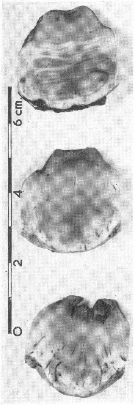 https://cdn.ncbi.nlm.nih.gov/pmc/blobs/b432/1844440/c432f000b778/brmedj02547-0035-c.jpg