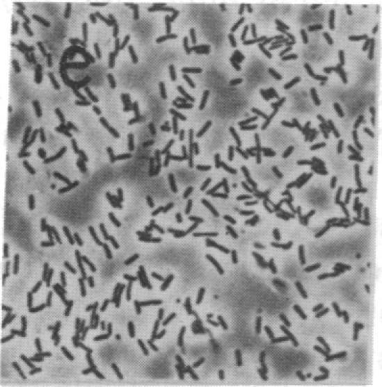 https://cdn.ncbi.nlm.nih.gov/pmc/blobs/b438/53424/20074bd8fb2a/pnas01028-0283-e.jpg