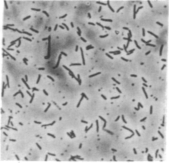 https://cdn.ncbi.nlm.nih.gov/pmc/blobs/b438/53424/d2ba0e484c34/pnas01028-0283-j.jpg