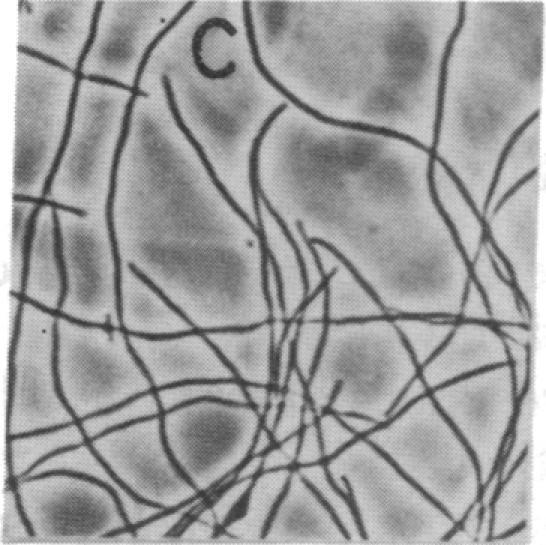 https://cdn.ncbi.nlm.nih.gov/pmc/blobs/b438/53424/f866ffae1e6c/pnas01028-0283-c.jpg