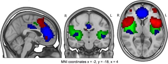 https://cdn.ncbi.nlm.nih.gov/pmc/blobs/b438/7729953/50238af83a80/41598_2020_78874_Fig1_HTML.jpg