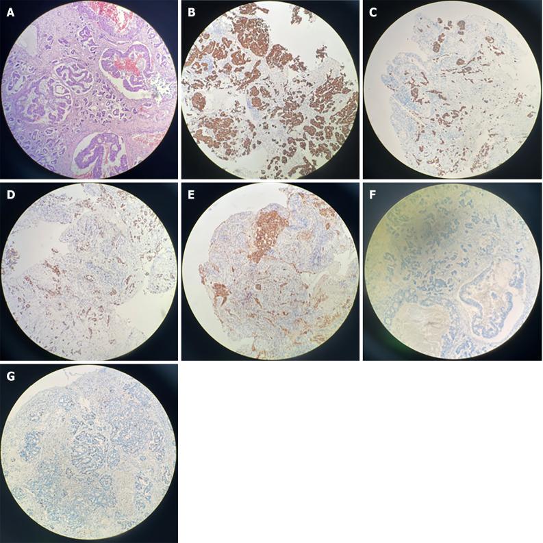 https://cdn.ncbi.nlm.nih.gov/pmc/blobs/b44a/11135431/4e631a3b2b85/WJCC-12-2597-g002.jpg