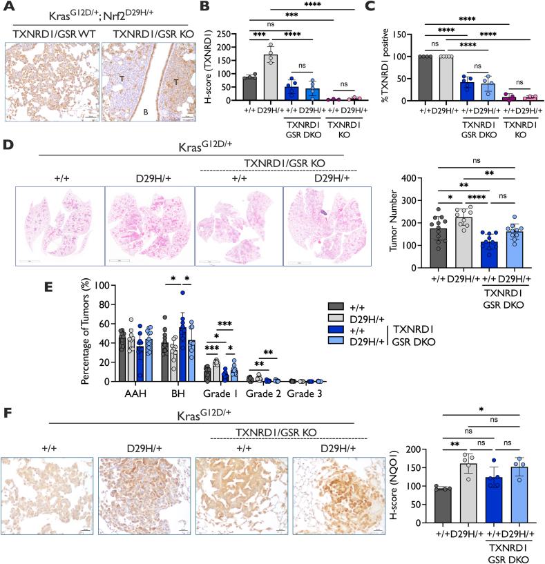 https://cdn.ncbi.nlm.nih.gov/pmc/blobs/b450/12133717/ca30d9189fd0/gr4.jpg