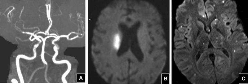 https://cdn.ncbi.nlm.nih.gov/pmc/blobs/b456/8078120/dc5b05005fad/str-52-1885-g002.jpg