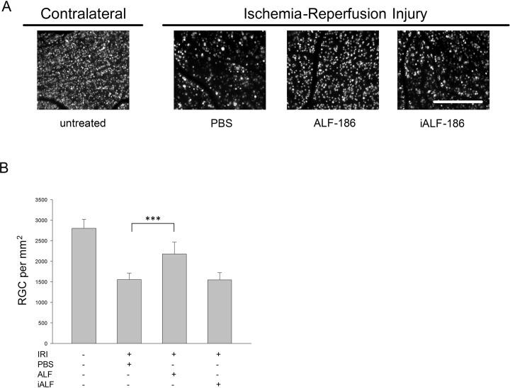 https://cdn.ncbi.nlm.nih.gov/pmc/blobs/b457/5703485/1ee491df439a/pone.0188444.g001.jpg