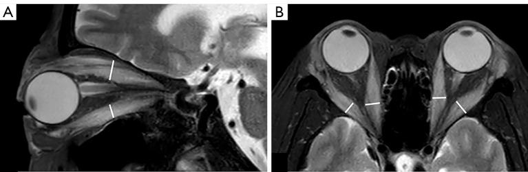 https://cdn.ncbi.nlm.nih.gov/pmc/blobs/b461/10167472/781da8c0d7b3/qims-13-05-3040-f2.jpg
