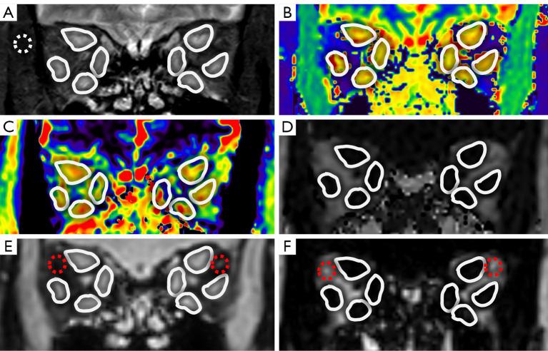 https://cdn.ncbi.nlm.nih.gov/pmc/blobs/b461/10167472/aacf60660878/qims-13-05-3040-f1.jpg