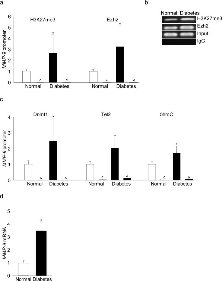 https://cdn.ncbi.nlm.nih.gov/pmc/blobs/b465/5737805/91385fac10f4/i1552-5783-58-14-6440-f08.jpg