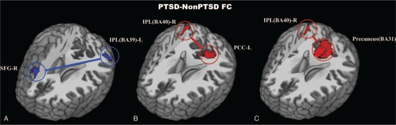 https://cdn.ncbi.nlm.nih.gov/pmc/blobs/b46d/5604633/a0c0b6986651/medi-96-e7826-g004.jpg