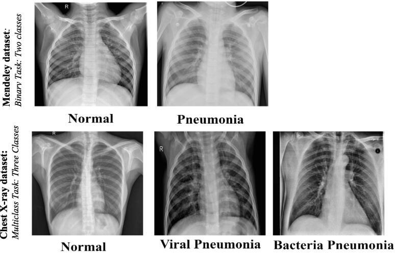 https://cdn.ncbi.nlm.nih.gov/pmc/blobs/b478/10248870/1a93b6427b7d/gr2.jpg