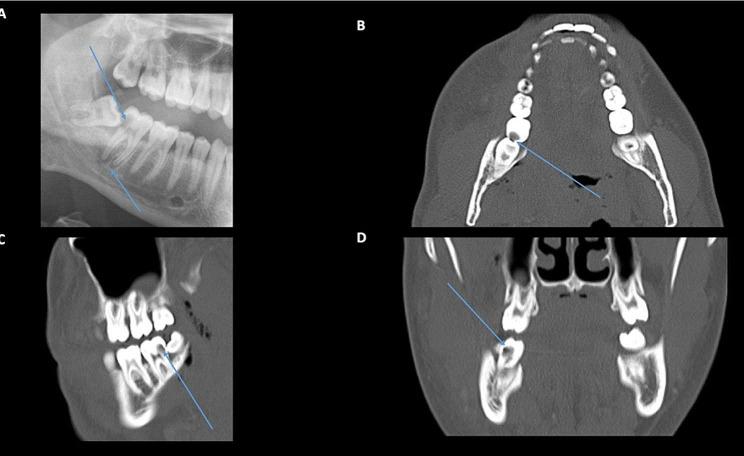 https://cdn.ncbi.nlm.nih.gov/pmc/blobs/b481/11445216/3b98459bcae5/12348_2024_422_Figa_HTML.jpg