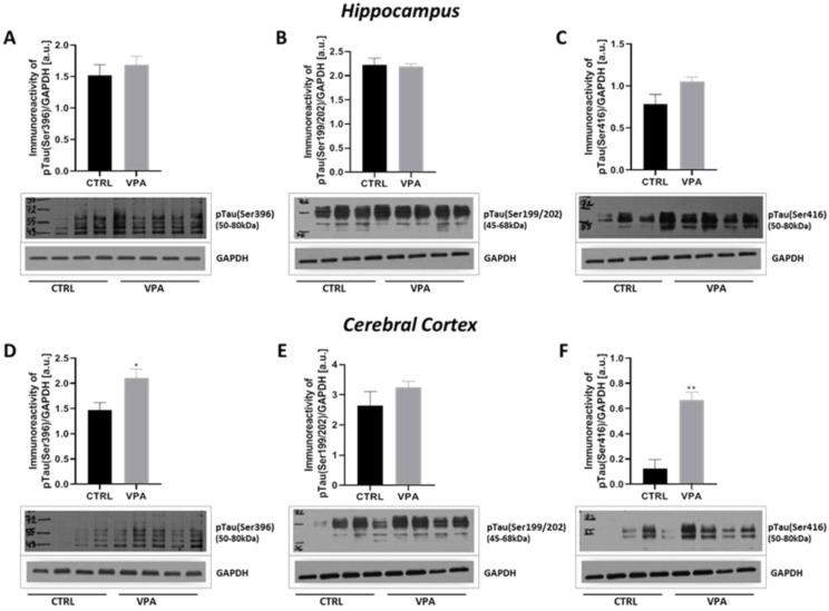 https://cdn.ncbi.nlm.nih.gov/pmc/blobs/b481/8004207/5057c9a65d99/ijms-22-03209-g005.jpg