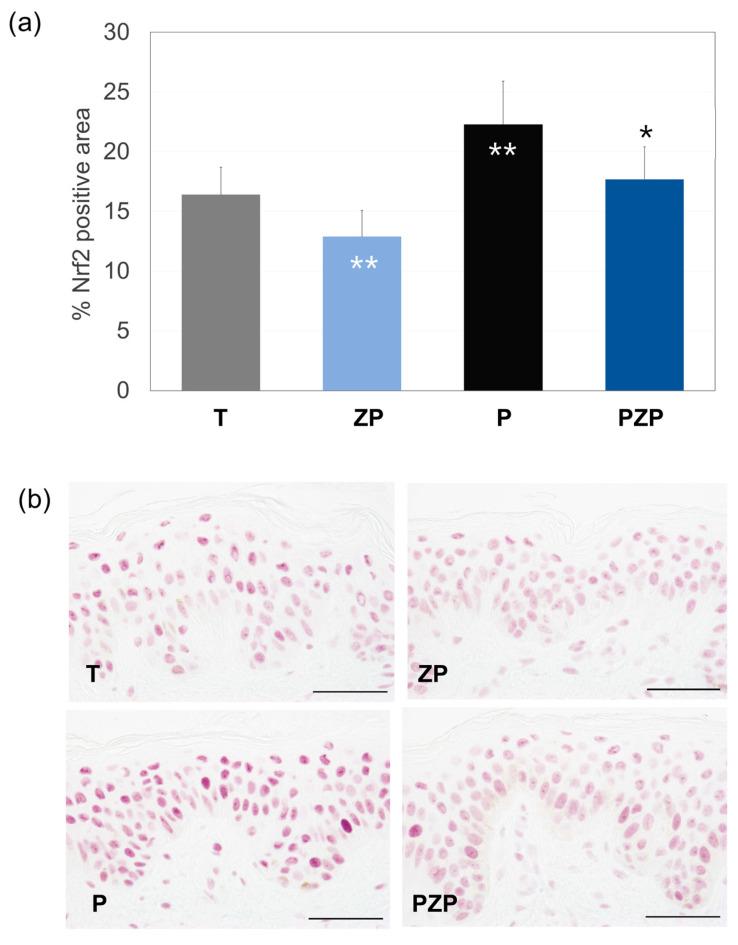 https://cdn.ncbi.nlm.nih.gov/pmc/blobs/b484/10887869/6fe646bda596/cimb-46-00099-g005.jpg