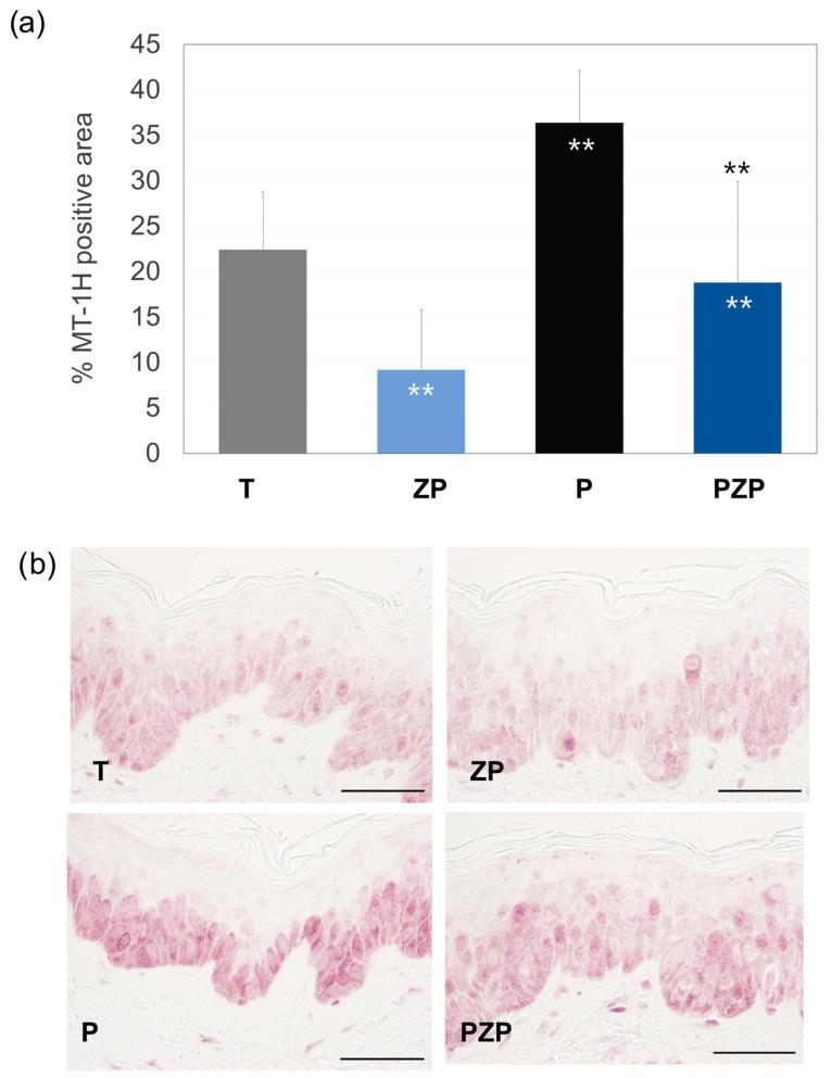 https://cdn.ncbi.nlm.nih.gov/pmc/blobs/b484/10887869/c8148743544c/cimb-46-00099-g004.jpg