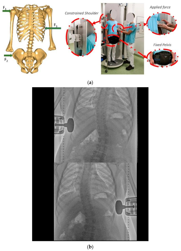 https://cdn.ncbi.nlm.nih.gov/pmc/blobs/b486/11676229/6b95abc391bd/jcm-13-07809-g002.jpg
