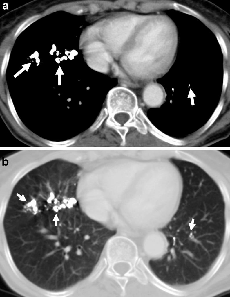 https://cdn.ncbi.nlm.nih.gov/pmc/blobs/b48f/3288859/cfeba54038f7/13244_2010_39_Fig4_HTML.jpg