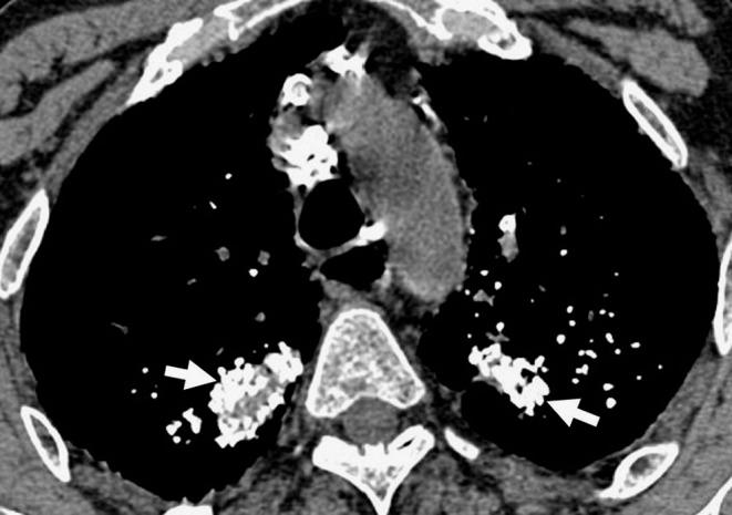https://cdn.ncbi.nlm.nih.gov/pmc/blobs/b48f/3288859/d89ec621e714/13244_2010_39_Fig3_HTML.jpg