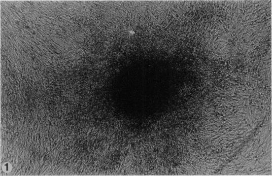 https://cdn.ncbi.nlm.nih.gov/pmc/blobs/b491/2041152/ab1c076f5f99/brjexppathol00142-0009-a.jpg