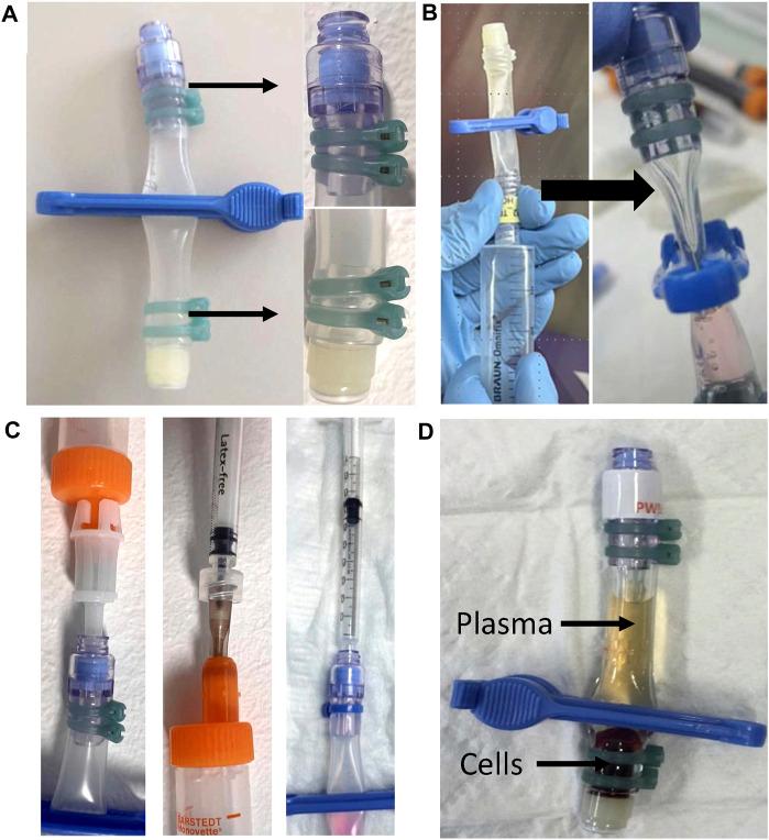 https://cdn.ncbi.nlm.nih.gov/pmc/blobs/b492/10823428/18d726fd0e03/fphys-14-1322852-g001.jpg