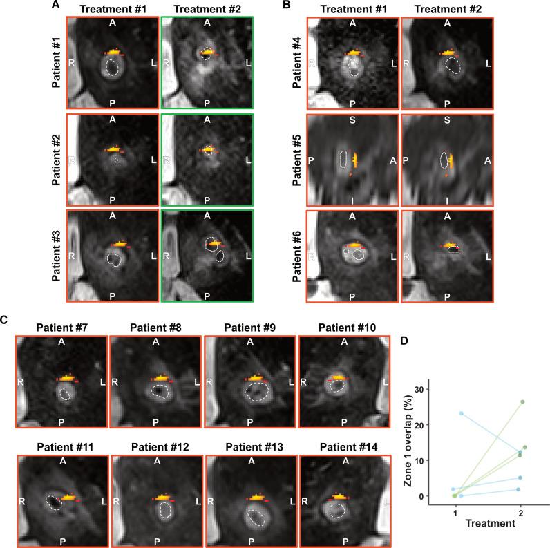 https://cdn.ncbi.nlm.nih.gov/pmc/blobs/b495/12077504/f0a1ff7712e1/sciadv.adp0532-f6.jpg